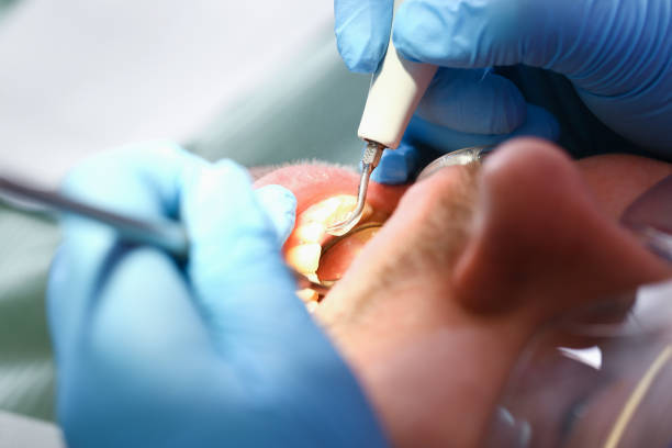 Best Emergency Treatment for Oral Infections in Clermont, FL